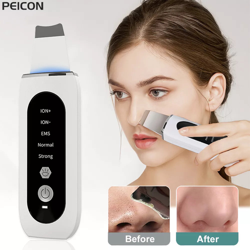 Ultrasonic Skin Peeling Blackhead Remover