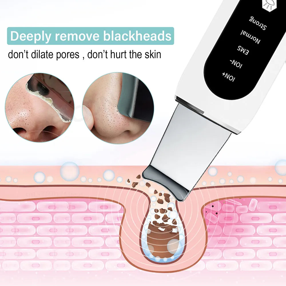 Ultrasonic Skin Peeling Blackhead Remover