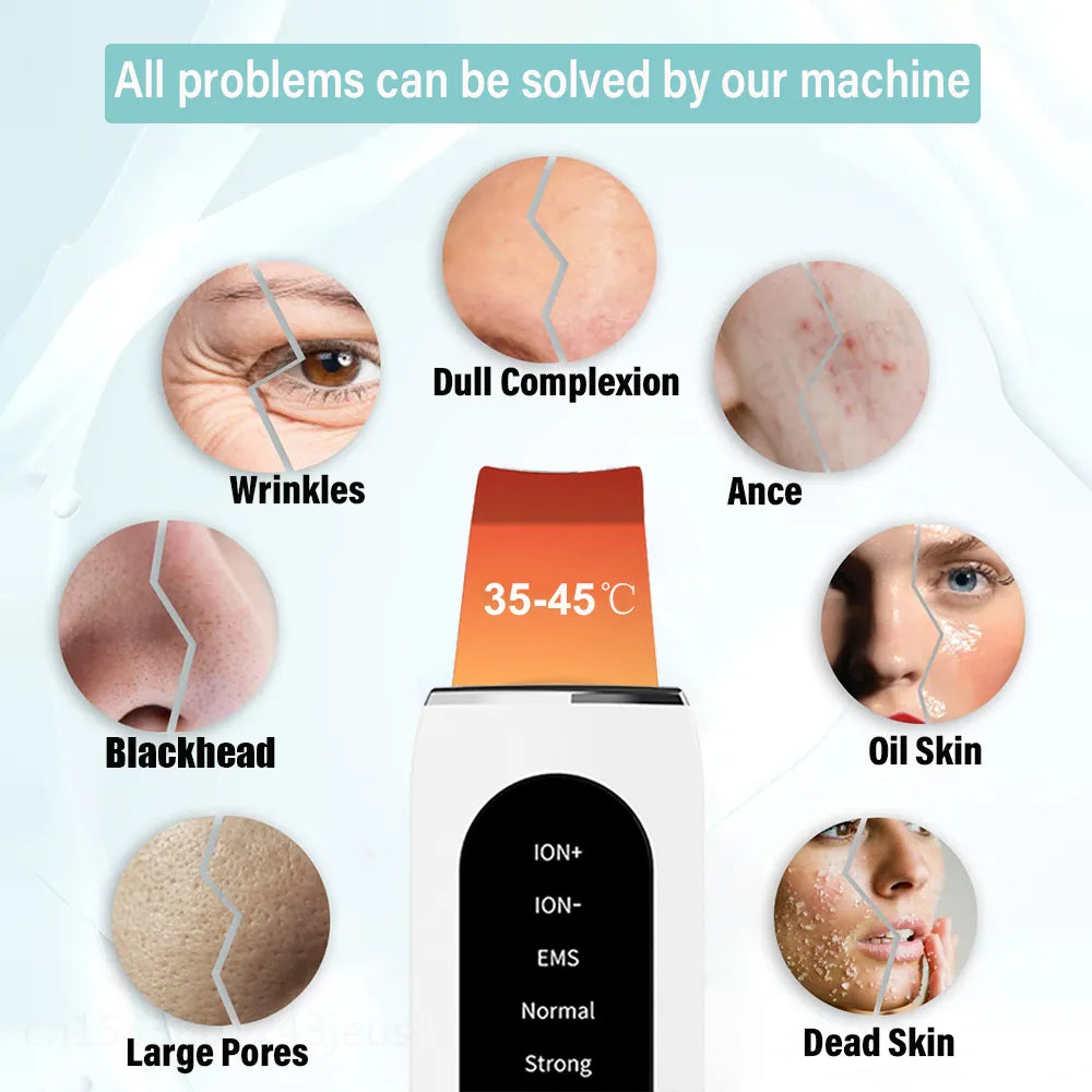 Ultrasonic Skin Peeling Blackhead Remover